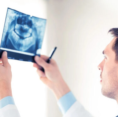 A dentist checking digital x-ray
