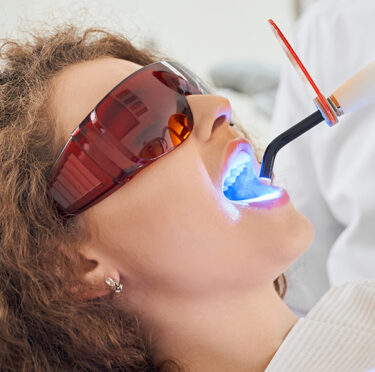 Teeth-Whitening Dentist Pearland TX