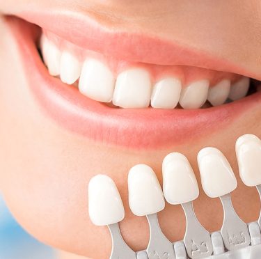 Paciente sonriente en Pearly Whites de Pearland con guía de colores de dientes.