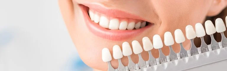 Paciente sonriente en Pearly Whites de Pearland con guía de colores de dientes.