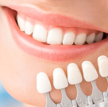 Paciente sonriente en Pearly Whites de Pearland con guía de colores de dientes.
