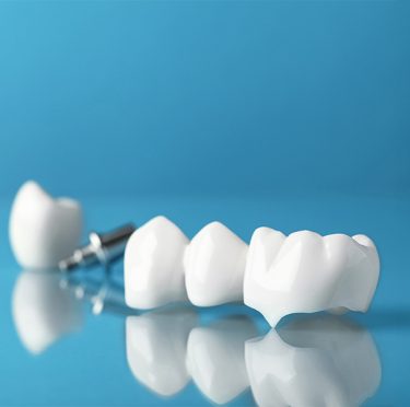 Coronas dentales sobre fondo azul en Pearly Whites of Pearland.